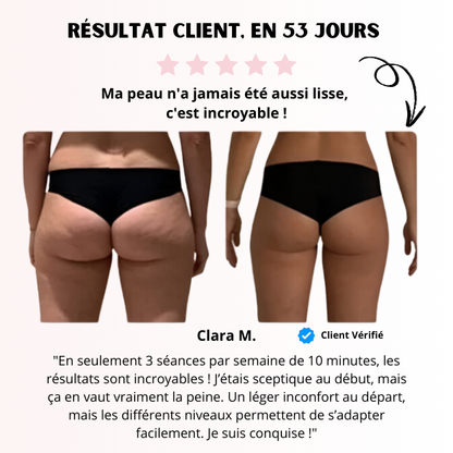 Masseur Anti-Cellulite
