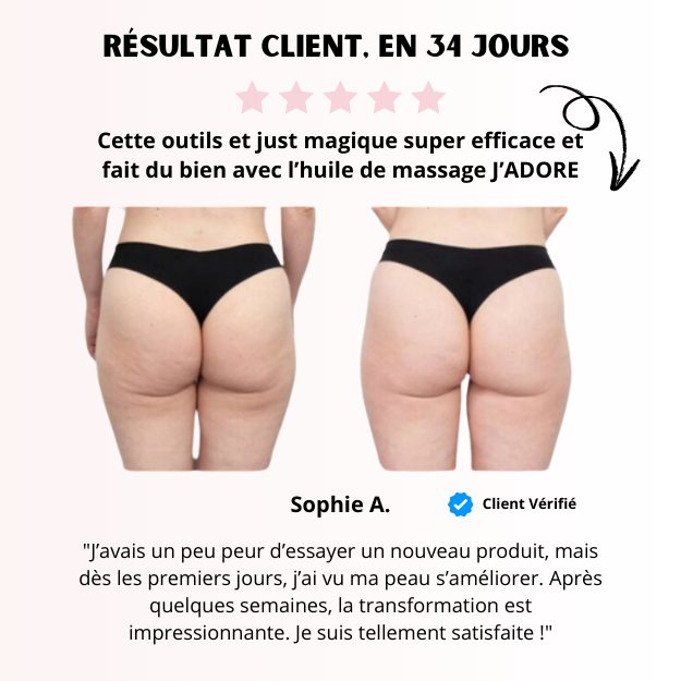 Masseur Anti-Cellulite