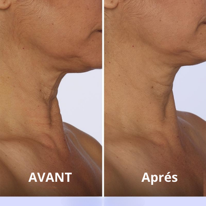 Crème Raffermissante et Liftante pour le Cou