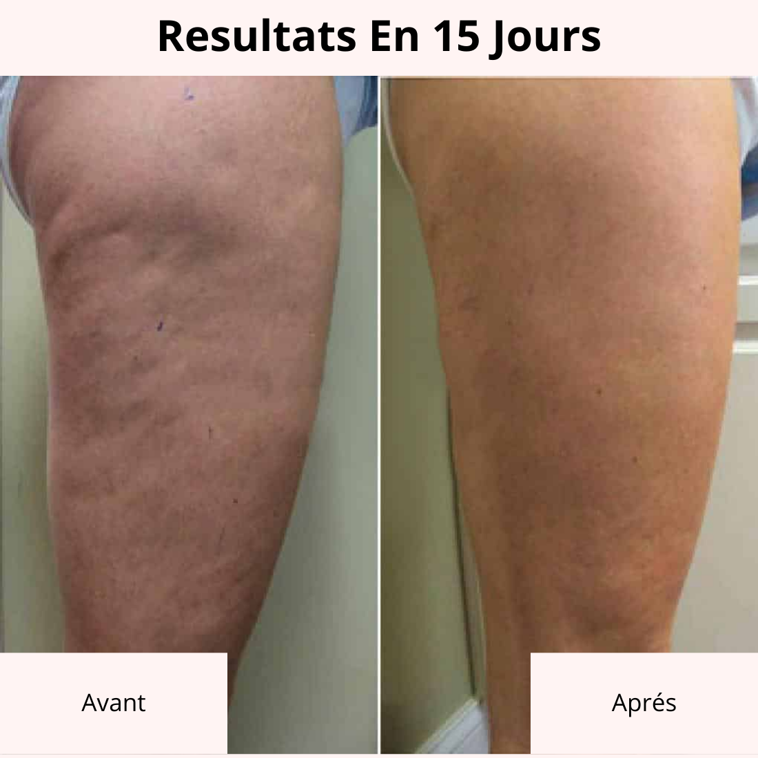 GET-DREAMY™ Creme raffermissant contre la Cellulite