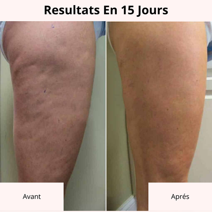 GET-DREAMY™ Creme raffermissant contre la Cellulite