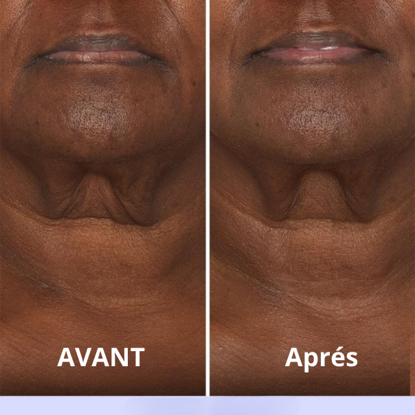 Crème Raffermissante et Liftante pour le Cou