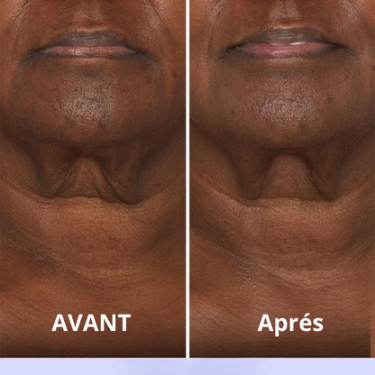 Crème Raffermissante et Liftante pour le Cou