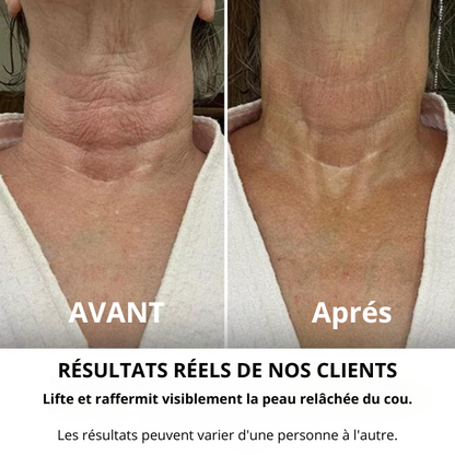Crème Raffermissante et Liftante pour le Cou