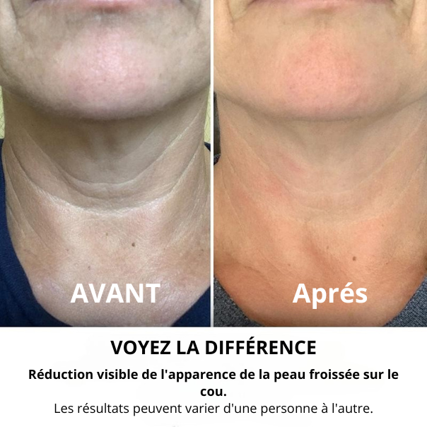 Crème Raffermissante et Liftante pour le Cou