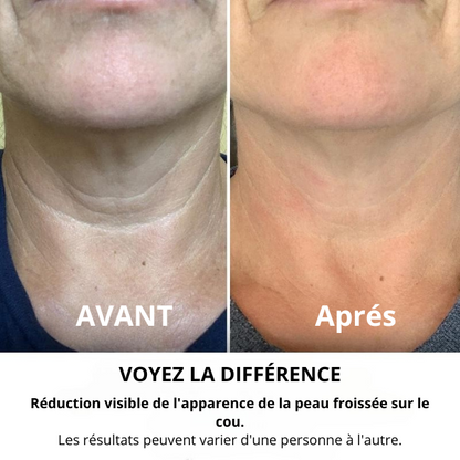 Crème Raffermissante et Liftante pour le Cou